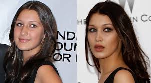 These photographic examples are intended for those individuals interested in cosmetic surgery. Bella Hadid Before And After Denies Plastic Surgery
