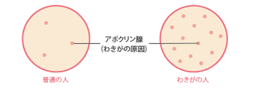 わきが 多汗症 千葉メディカルセンター美容外科