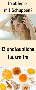 Die Besten Hausmittel Gegen Schuppen Egal Ob Trockene Kopfhaut Oder Fettige Schuppen Meine Naturlichen Home Remedies For Dandruff Dandruff Remedy Greasy Skin