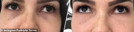 1280 x 720 jpeg 81 кб. Now Women Are Getting Their Dark Circles Tattooed Away With Permanent Concealer Daily Mail Online