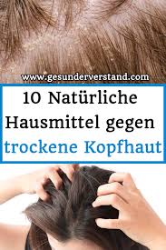Pin Von Inez Van Auf Bad In 2020 Trockene Kopfhaut Hausmittel Trockene Kopfhaut Hausmittel