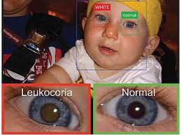 Sozdano Prilozhenie Opredelyayushee Rak Po Foto Ferra Ru
