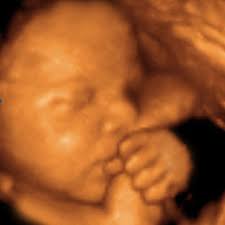 3d Ultrasound Ottawa Gatineau On Uc Baby Client Testimonials And Reviews