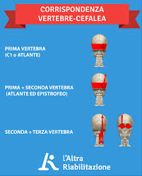 Mal Di Testa 7 Segnali Di Quando La Causa E Cervicale Come Risolvere