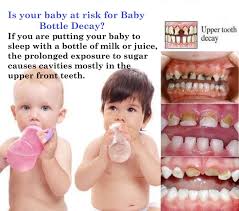 Smilesofsanmarcos Baby Bottle Tooth Decay Dental Fun Tooth Decay