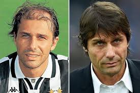 Non pensiamo che lautaro ci risolva la situazione. Antonio Conte Calciatori E Ritocchini I Campioni Prima E Dopo Il Chirurgo Virgilio Sport