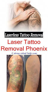 New Tattoo Removal Can Laser Hair Removal Work On Tattoos Tattoo Removal Business Dermatologist Tatto Tattoo Removal Results Tattoo Removal Cost Laser Tattoo