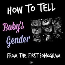 Pin On Pregnancy