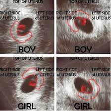32 Old Wives Tales For Baby Gender Prediction Baby Gender Prediction Baby Gender New Baby Products