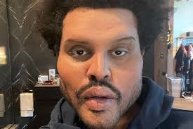 The weeknd prompts fan speculation about plastic surgery after revealing new look in 'save your tears' video. Did Blinding Lights Ruin The Weeknd S Face See His New Look Film Daily