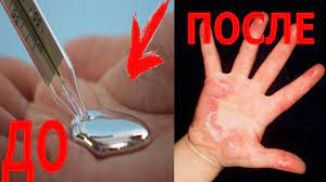 Chto Budet Esli Razbit Rtutnyj Gradusnik Youtube