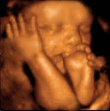 3d Ultrasound Pictures Ultrasound Pictures 3d Ultrasound Baby Ultrasound