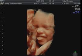 Pin On Places To Go For Ultrasound Scan