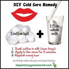 This Is A Fast Inexpensive Cold Sore Remedy Share Like Re Pin Comment Cold Sores Remedies Cold Sore Cold And Cough Remedies