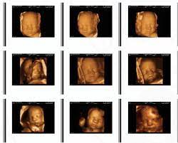 Pin On Womens Health