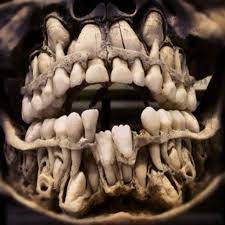 Community Post Creepy Skull With Two Sets Of Teeth Childs Skull Skull Baby Teeth