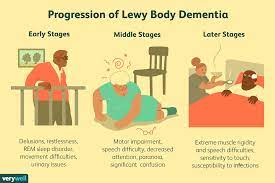 Living at home with nursing support. Stages And Progression Of Lewy Body Dementia