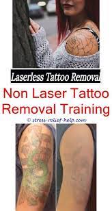 The price is dependent on several factors, including the type and extent of the tattoo, and the expertise and training of the surgeon. Tattoo Removal Cream How Did Johnny Depp Remove His Tattoo Laser Tattoo Removal Cost Estimate Custom Temporary Diy Tattoo Diy Tattoo Permanent Tattoo Removal
