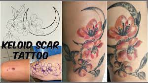 Keloid, keloid scar removal, keloid treatment, keloid scar. Keloid Scar Tattoo Cover Up Story Tips Youtube