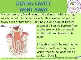 Young Living Thieves Essential Oil Dental Cavity Testimonial Essential Oils Health Living Essentials Oils Essential Oils