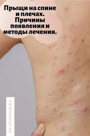 Pin On Krasota I Zdorove Health And Beauty