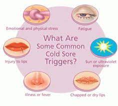 10 Cold Sores Ideas Cold Sore Soreness Cold Sores Remedies