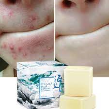 Mite Soap Rich In Sea Salt Soap Bar Quickly Remove Mites Repair Nourish Skin Personal Care Product Soap For Acne Soap Aliexpress