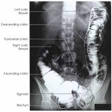 Pin On Abdomen Gi Series