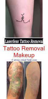 Most of the time a tattoo can be removed — but with certain inks, it may not be possible to entirely. Tattoo Removal San Diego Does Getting A Tattoo Removed Leave A Scar Does Laser Tattoo Removal Feel Like Laser H Tattoo Removal Laser Tattoo Tattoo Removal Cost