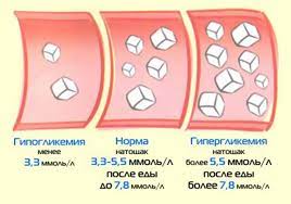 Simptomy I Priznaki Povyshennogo Sahara V Krovi Rannie I Pozdnie Vasha Onlajn Bolnica