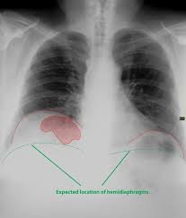 Pin On Radiology