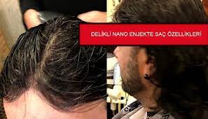 Seboreik Dermatit Nedir Belirtileri Ve Tedavisi Nasil Olur Sac Saglik