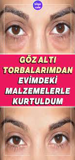 Goz Alti Torbalarimdan Evimdeki Malzemeler Sayesinde Kurtuldum Cilt Bakimi Tuyolari Saglikli Cilt Bakimi Ev Yapimi Cilt Bakimi