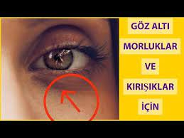 Goz Alti Morluklarini Gideren Elma Maskesi Goz Cevresi Kirisiklara Krem Tarifi Guzellik Bakim Youtube Gozler Guzellik Elmalar
