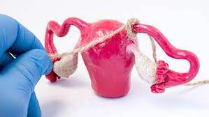 Dacă ai o viată sexuală activă care e primul lucru la care te gândeşti? De Ce Intarzie Menstruatia Motive Pentru Intarzierea Ciclului Menstrual Revista Baby Pentru PÄƒrinti È™i Copii