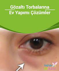 Gozalti Torbalarina Ev Yapimi Cozumler Sabah Uyanip Aynaya Baktiginizda Ve Gozlerinizin Altinda Morluklar Oldugund Homemade Skin Care Skin Care Beauty Hacks