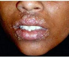 Mboo ndefu , free hd mboo ndefu mp4 videos, mboo ndefu songs, mboo ndefu download, video mboo ndefu clips, mboo ndefu video songs. Madhara Ya Kunyonya Uume Uke Habari Na Matukio