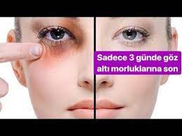 Goz Alti Morluklarina Kesin Cozum Goz Alti Koyu Halkalar Goz Alti Torbalar Dogal Maske 100 Sonuc Youtube Cilt Beyazlatma Cilt Urunleri Cilt Ipuclari