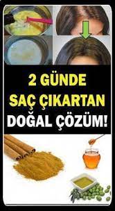 What You Should Do About Hair Loss And Brittle Nails Treatment Healthy Medicine Tips Hair Loss Regrow Hair Oil For Hair Loss