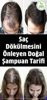 Sac Dokulmesini Onleyen Dogal Sampuan Tarifi Hair Beauty Beauty Hair