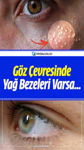 Yag Bezeleri Icin Bitkisel Tedaviler Dogal Cozumler Faydali Bilgin Dogal Akne Tedavisi Konturlama Akne Tedavisi