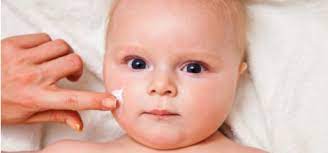 Bebeklerde Terleme Egzamaya Sebep Olabilir Central Hospital