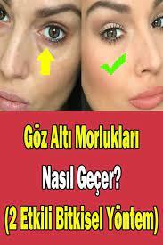 Goz Alti Morluklari Nasil Gecer Bitkisel Cozumler Sosyolife Net Ev Yapimi Cilt Bakimi Cilt Bakimi Cilt Urunleri