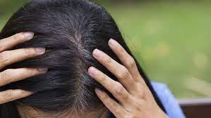Sac Boyasi Degil Tamamen Dogal Bu Su Ile Beyaz Saclarinizdan Tamamen Kurtulacaksiniz Evet Sac Boyasi Yok Sadece Bu Siy Grey Hair Roots Roots Hair Hair Myth