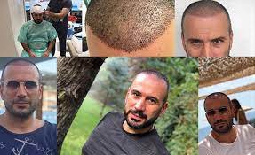 Ertem Sener Nerede Sac Ektirdi New Gokturk Dergisi 10 Yil