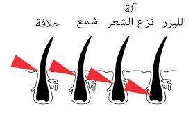 جهاز فلوليس لإزالة الشعر المميزات والانواع تجميلي
