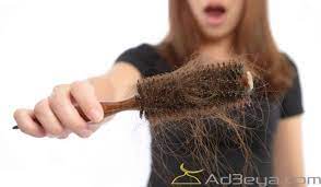 تفسير حلم سقوط الشعر في المنام بالتفصيل تفسير ابن سيرين تفسير ابن شاهين تفسير النابلسي Hair Fall Remedy Stop Hair Loss Hair Loss