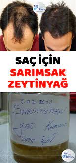 Sac Icin Sarimsak Ve Zeytinyagi Etkisi Strong Hair Hair Growth Home Remedies Hair Cure