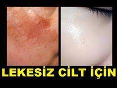 15 Dakikada Gunes Lekesi Yaslilik Lekesi Giderici Beyazlatici Dogal El Bakimi Diy Youtube Cilt Bakimi Dogal Cilt Bakimi Dogal