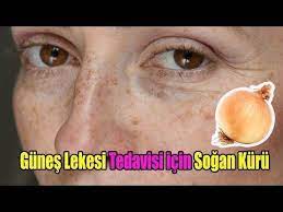 Gunes Lekelerine Kesin Cozum Gunes Lekeleri Nasil Gecer Gunes Lekeleri Icin Maske Youtube Maskeler Dogal Guzellik Ipuclari Dogal Cilt Bakimi